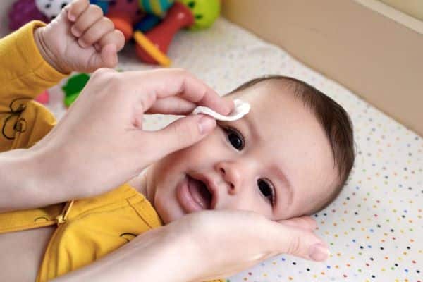 Bebê sendo higienizado nos olhos após ter recebido colírio para glaucoma.