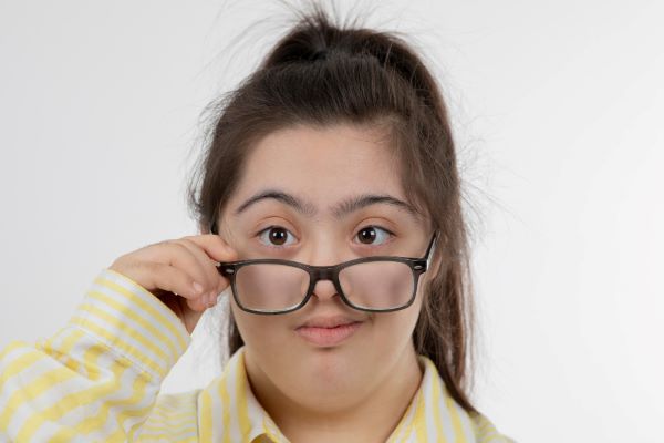 Garota adolescente com síndrome de down, com os cabelos amarrados em rabo de cavalo e vestindo uma camisa listada de amarelo e branco, segura um par de óculos de grau preto frente aos olhos. Ela apresenta estrabismo no olho esquerdo. 
O Down é uma condição genética que pode originar o estrabismo.